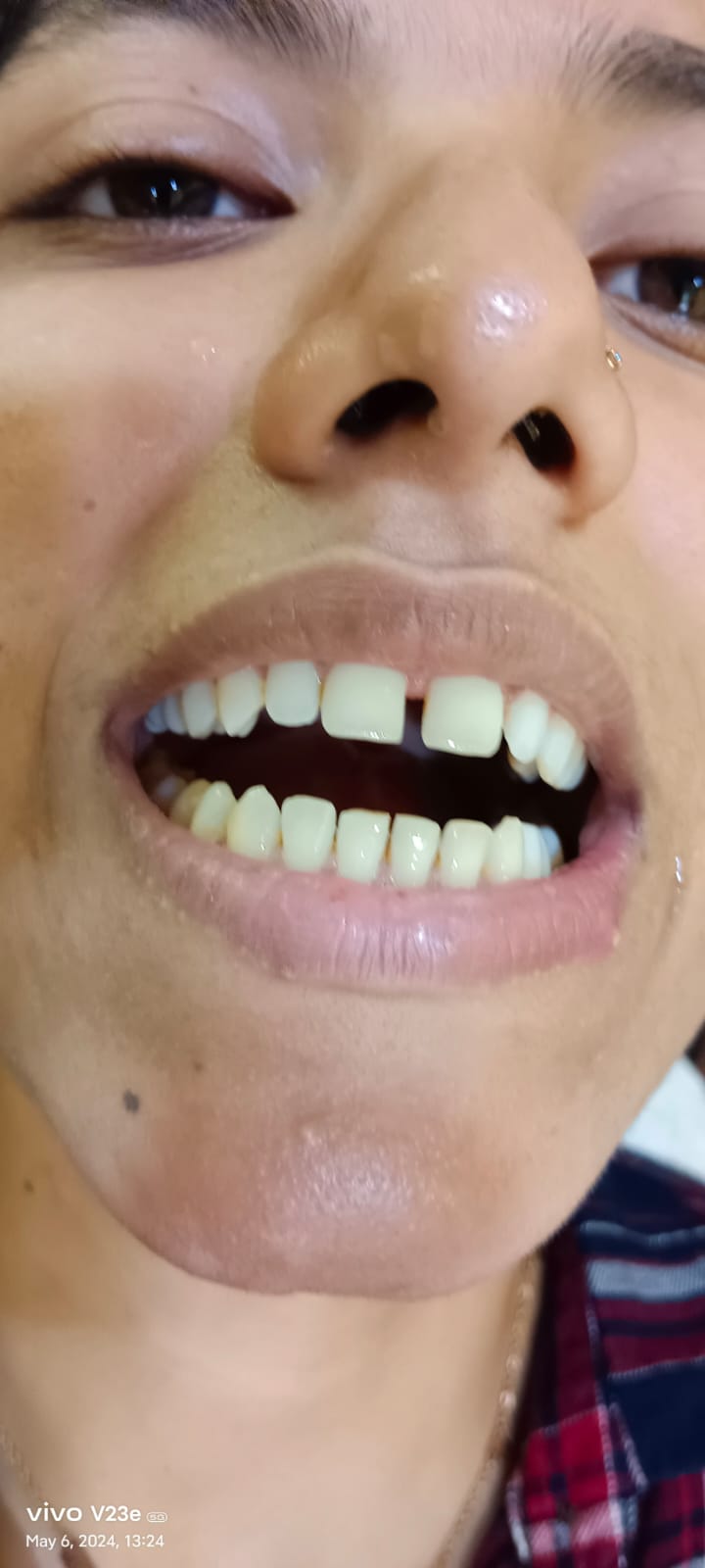 dental habra