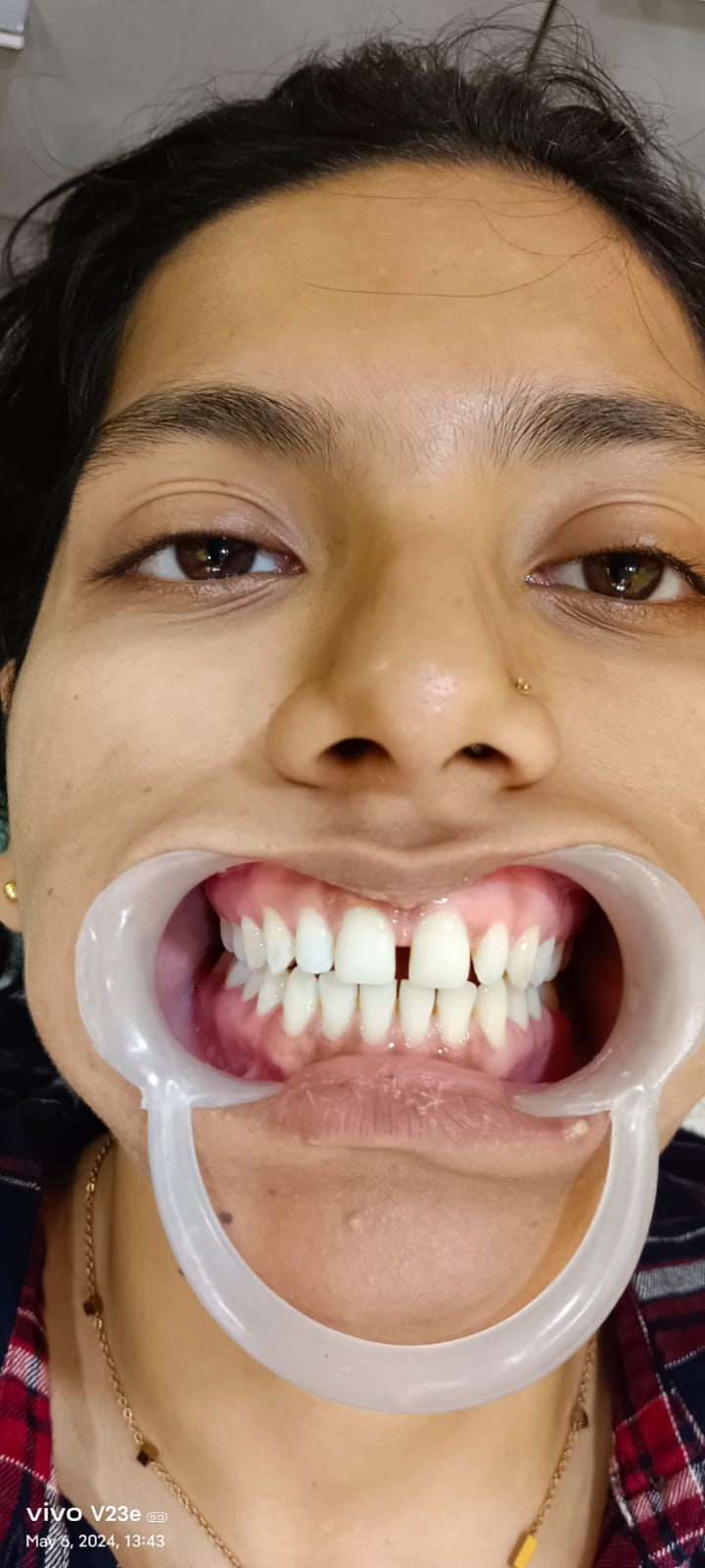 dental habra