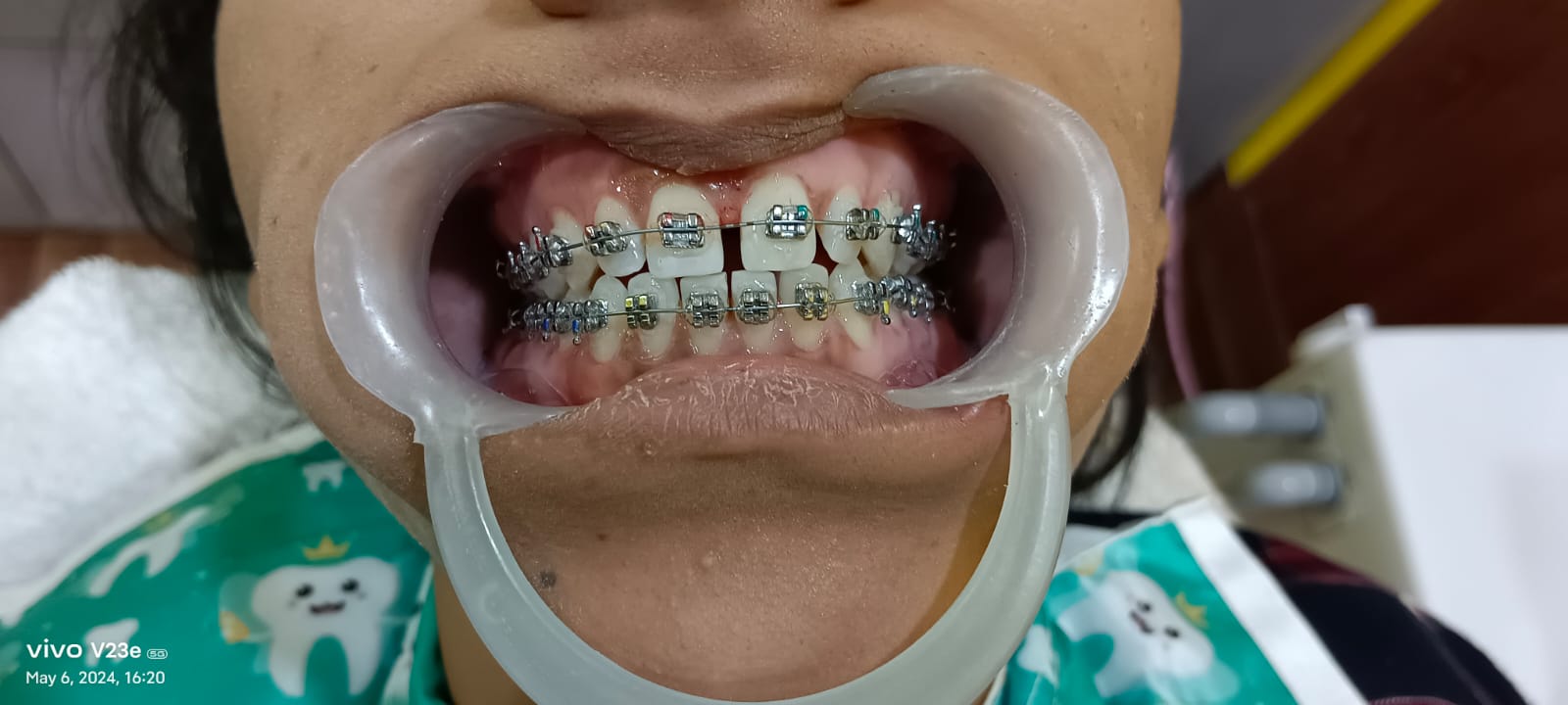 dental habra