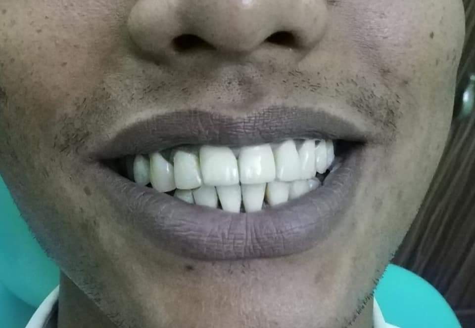 dental habra