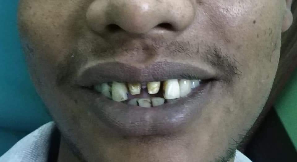 dental habra