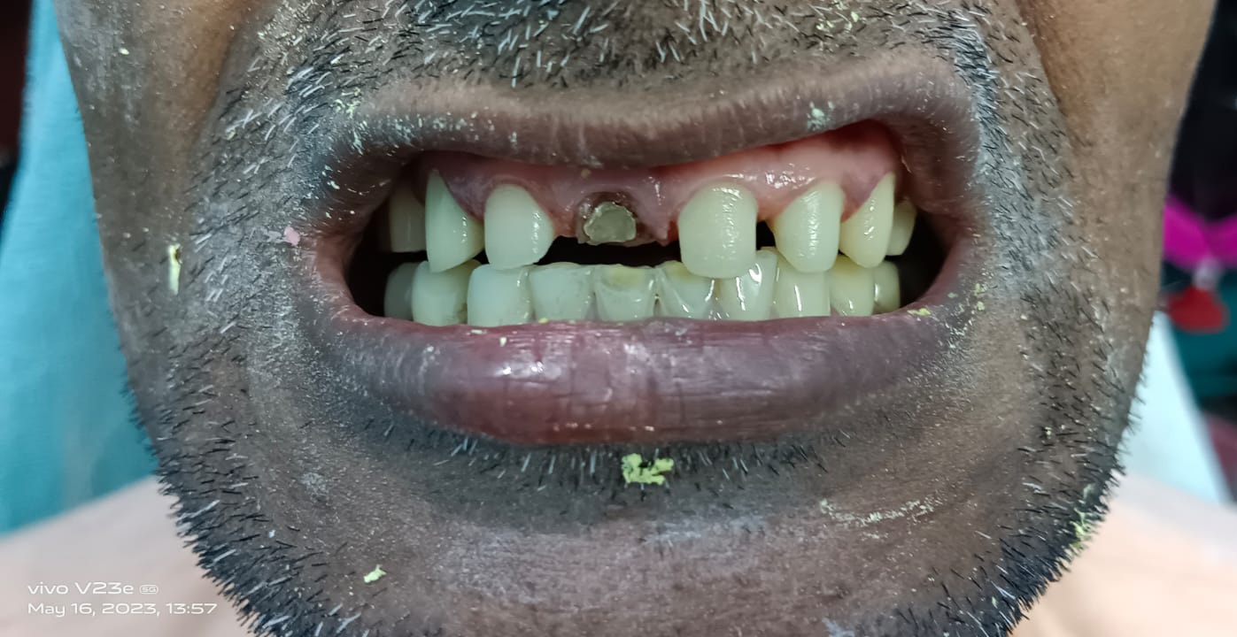 dental habra