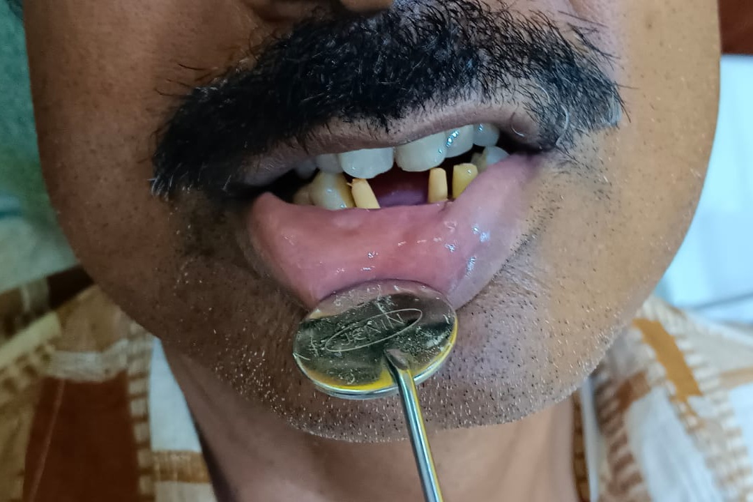 dental habra